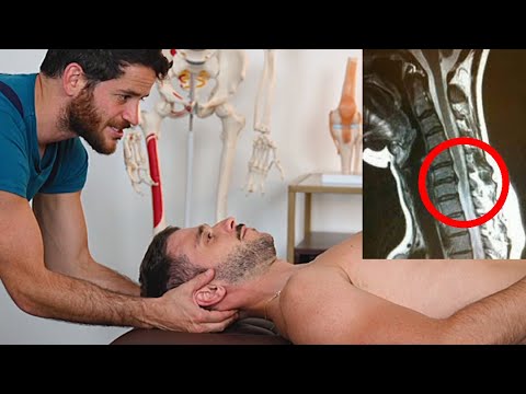 Les ( VRAIES ) solutions pour la hernie discale cervicale ( KINÉ )