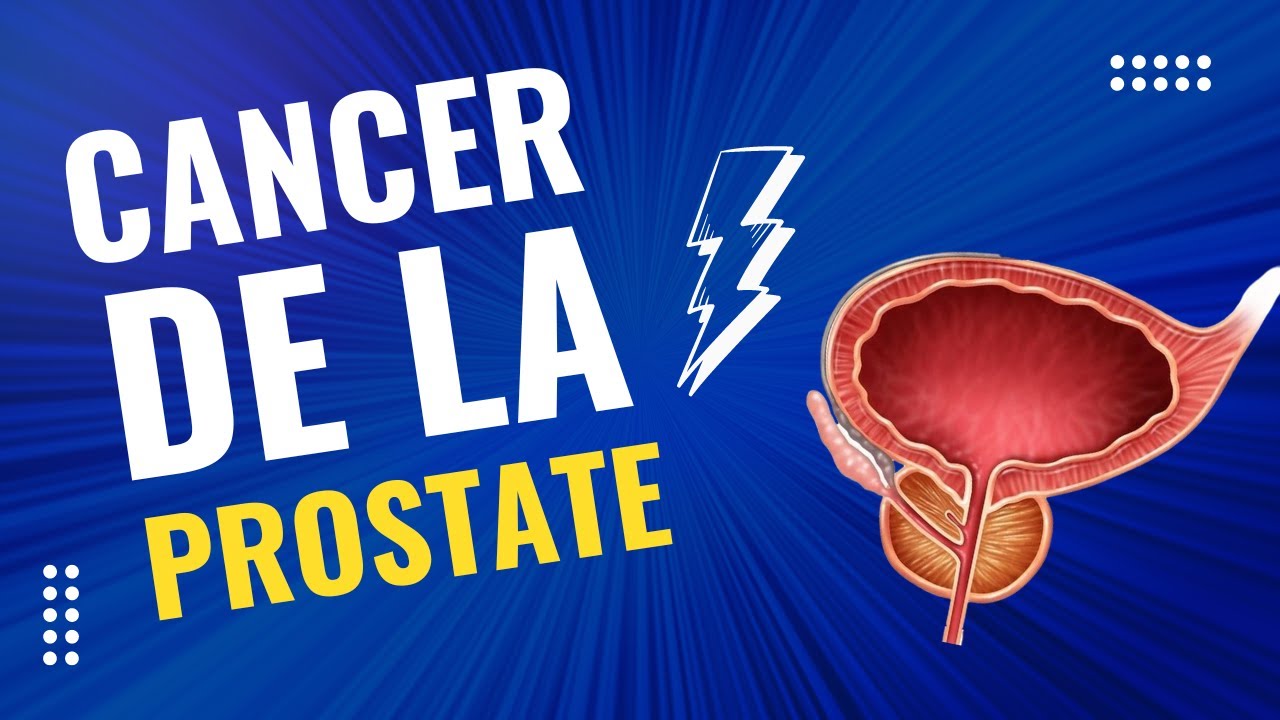 Comprendre le Cancer de la Prostate : Symptômes, Diagnostic et Traitements