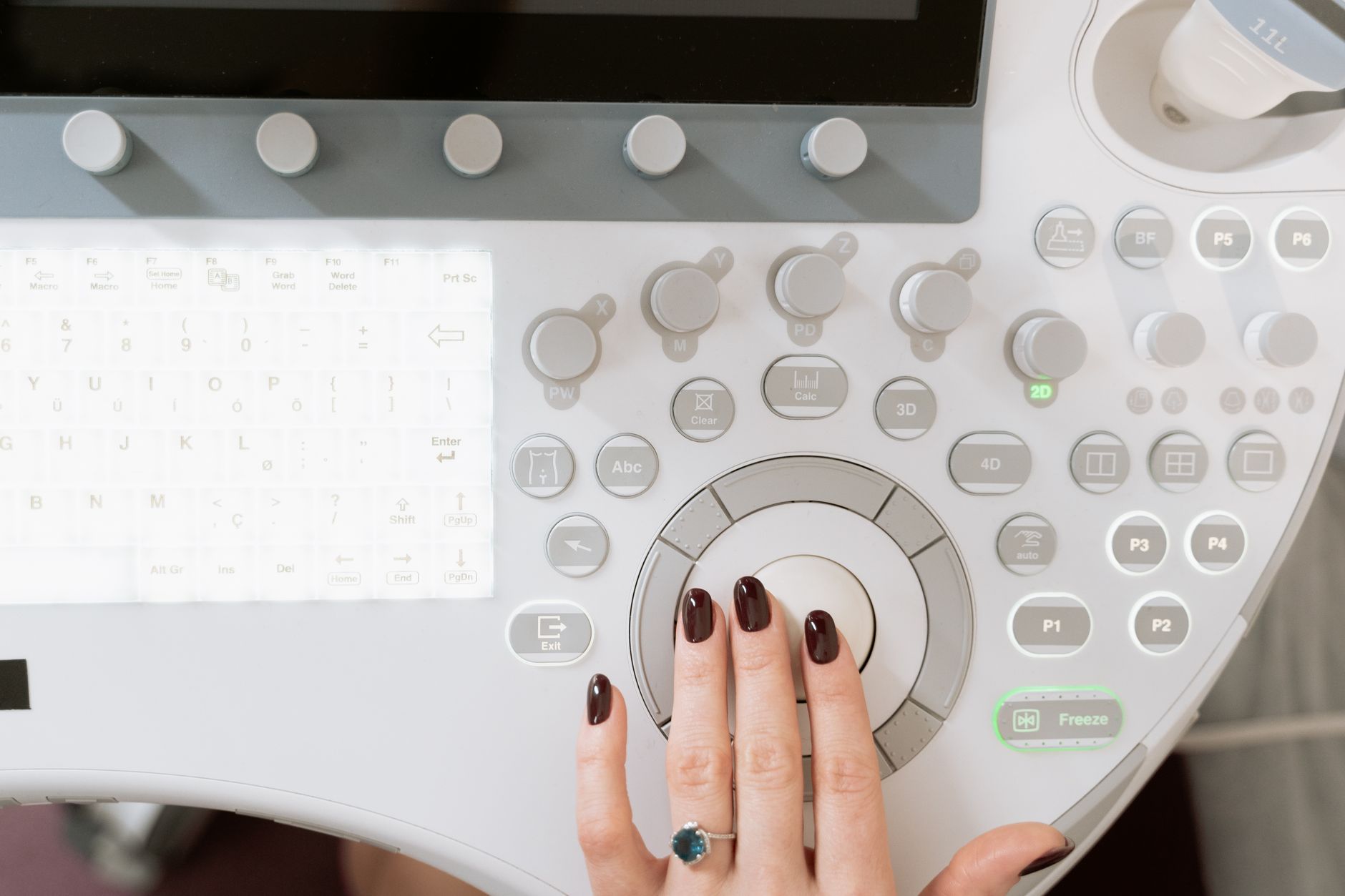 Comment confirmer un diagnostic d’endométriose : méthodes et examens clés